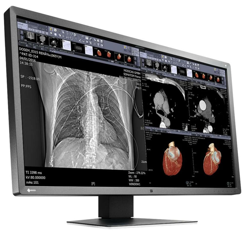 EIZO RadiForce MX315W