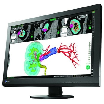 EIZO RadiForce MX242W