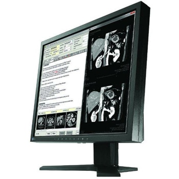 EIZO RadiForce MX194