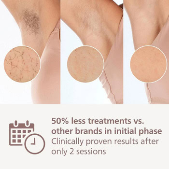 Philips Lumea IPL 7000 Series BRI923/00