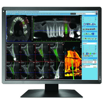 EIZO RadiForce MX216-HB