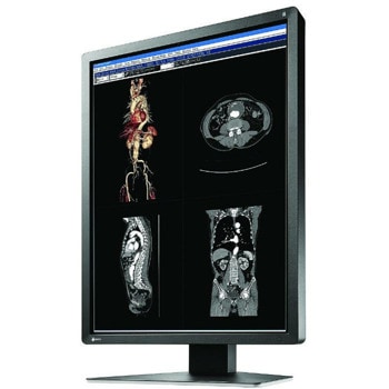 EIZO RadiForce MX216-HB