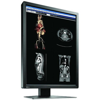 EIZO RadiForce MX216-HB