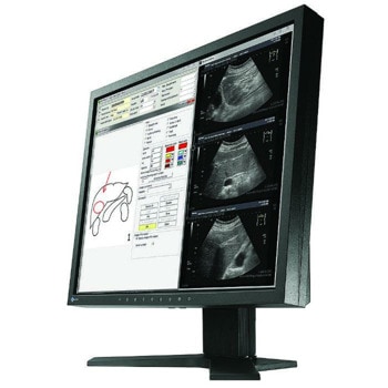 EIZO RadiForce MX194