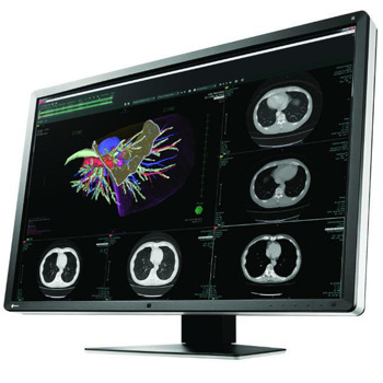 EIZO RadiForce RX660