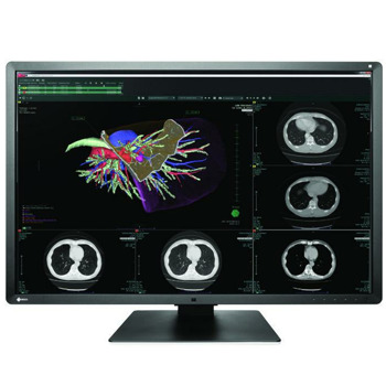 EIZO RadiForce RX660