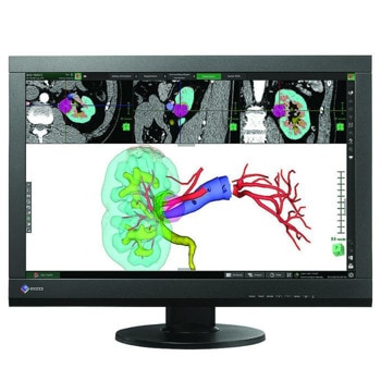 EIZO RadiForce MX242W